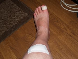 Injuries